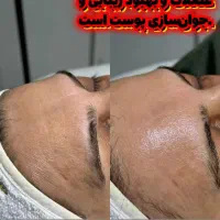 آموزش فشیال،مراقبت از پوست و تجهیزات پوست|خدمات آموزشی|نجف‌آباد, شریعتی|دیوار