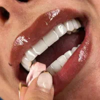 کلیه خدمات دندانپزشکی با بیمه های تکمیلی