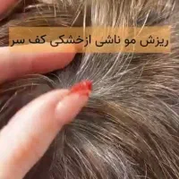 افر ویژه خدمات اسکراب کف سر-درمانی ۲.۵۰۰ تومان|خدمات آرایشگری و زیبایی|کیش, |دیوار