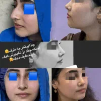 جشنواه ویژه  خدمات   عمل بینی لیپو ساکشن|خدمات آرایشگری و زیبایی|اهواز, کیانپارس |دیوار