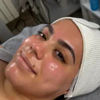 تخفیف ویژه فیشال