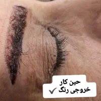 ریموور تتوهای قدیمی و تیره|خدمات آرایشگری و زیبایی|بندر کنگان, |دیوار
