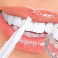 قلم سفید کننده دندان /لمینت/زیبایی/کامپوزیت|خدمات آرایشگری و زیبایی|ایلام, |دیوار