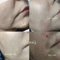 تخفیف روز مادر|آرایشی، بهداشتی، درمانی|مسجد سلیمان, |دیوار