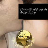 کلینیک لیزر پوست،مو جهانطلا در کرمانشاه (فوتونا)|خدمات آرایشگری و زیبایی|کرمانشاه, |دیوار