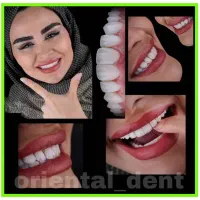 قسطی ایمپلنت و تمام خدمات دندانپزشکی بدون پیش