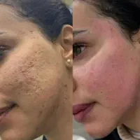 خدمات زیبایی بانوان و دوشیزگان|خدمات آرایشگری و زیبایی|ایذه, |دیوار