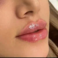 تزریق صورت و بدن