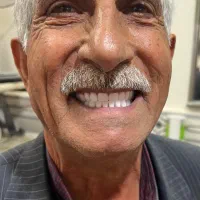 دندان مصنوعی