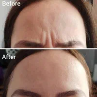 آموزش لابیا پلاستی کاشتمو ساکشن چربی|خدمات آموزشی|تهران, ستارخان|دیوار