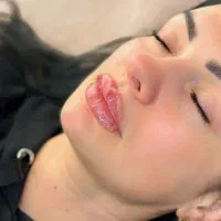 ژل  و بوتاکس