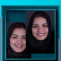 پیشنهادویژه عصبکشی دندان درپایتخت دندانپزشکی شیراز|خدمات زیبایی و سلامت|شیراز, ارم|دیوار