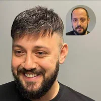 پروتز مو  زیبایی و جوانی