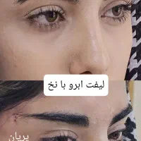 جشنواره تخفیف فیلر فول فیس ژل بوتاکس نخ هایفو|خدمات آرایشگری و زیبایی|مشهد, فرهنگ|دیوار