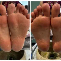 خودم پدیکوریست هستم|استخدام درمانی، زیبایی، بهداشتی|رشت, انصاری|دیوار