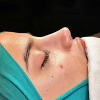 اخرین جشنواره عمل جراحی بینی لیپو ابدو لیفت وساکشن|خدمات آرایشگری و زیبایی|قم, شهرک امام حسن|دیوار