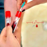 مزوتراپی و پی آر پی مو و ابرو|خدمات آرایشگری و زیبایی|اردبیل, |دیوار