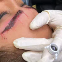 میکرو ،شیدینگ،فیبروز