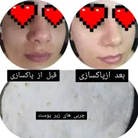 فیشیال تخصصی پوست به مدت محدود فقط۲۰۰تومن|خدمات آرایشگری و زیبایی|مشهد, طبرسی شمالی|دیوار