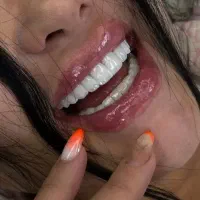 زیبایی دندان