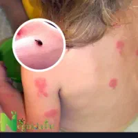 خدمات سمپاشی %100تضمینی تمام نقاط تهران|خدمات نظافت|تهران, آهنگ|دیوار