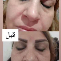 کرم سوپر vip
