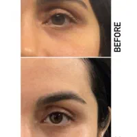 تزریق ژل و بوتاکس توسط پزشک|خدمات آرایشگری و زیبایی|بروجرد, |دیوار