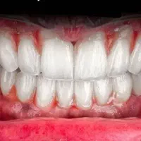 مرکز تخصصی دندان پزشکی و ایمپلنت مختص افراد حساس|خدمات زیبایی و سلامت|تبریز, |دیوار