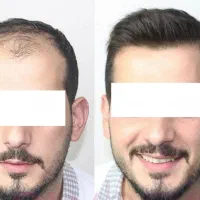 دیگه خودتو نباز واسه موهات
