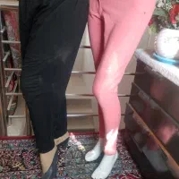 مانکن