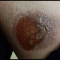 خدمات پرستاری در منزل