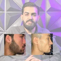 معجزه ریش سیبیل