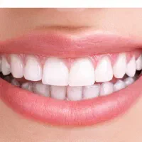 خدمات دندانپزشکی دولتی با کمترین قیمت