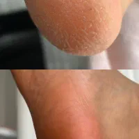 ناخن|خدمات آرایشگری و زیبایی|بابلسر, |دیوار