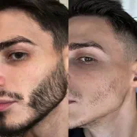 پرپشت شدن ریش