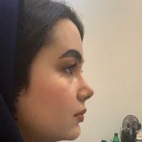 جشنواره عمل بینی برای مراجعین سلماس/درتهران/۴۳تومن