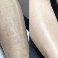 لیزر موهای زائد بانوان فول بادی  فقط ۲۹۹ مدت محدود|خدمات آرایشگری و زیبایی|تبریز, |دیوار