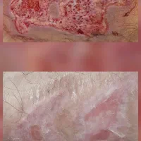کارشناس و درمانگر زخم ،خدمات پرستاری در منزل|خدمات آرایشگری و زیبایی|برازجان, |دیوار