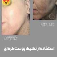 کلینیک زیبایی و لیزر در تهرانسر