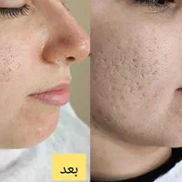 پاک کردن تتو، پیرسینگ ، نگین دندان|خدمات آرایشگری و زیبایی|اصفهان, وحید|دیوار