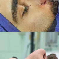 عمل زیبایی بینی،با قیمت پارسال
