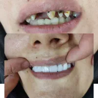 دندانپزشکی صدف (با شرایط اقساط)