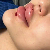 خدمات ژل و بوتاکس