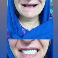 دندان های مرواریدی داشته باشید|پزشکی|اراک, |دیوار