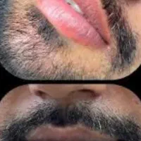 بازگشت رنگ طبیعی لب /تضمینی