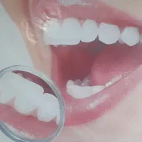 کامپوزیت واحدی ۱۳۰۰عصب کشی ۲میلیون(سنندج)