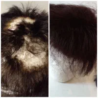 پروتز مو...انجام انواع خدمات حتی در محل|خدمات آرایشگری و زیبایی|رشت, بلوار گیلان|دیوار