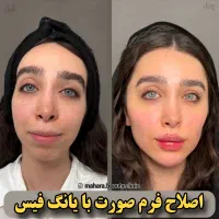 تخفیف یانگ فیس صورت ابرو پزشک پوست مو بینی زیبایی|خدمات آرایشگری و زیبایی|مشهد, هفت تیر (آب و برق)|دیوار