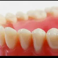 دندانسازی تخصصی دنیز|خدمات آرایشگری و زیبایی|زنجان, |دیوار