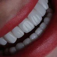 نیازمنددندانپزشک باپروانه محمدشهر